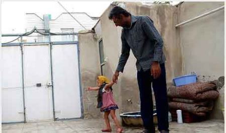 دختر ایرانی که در پوست خود آتش می گیرد و می سوزد! عکس