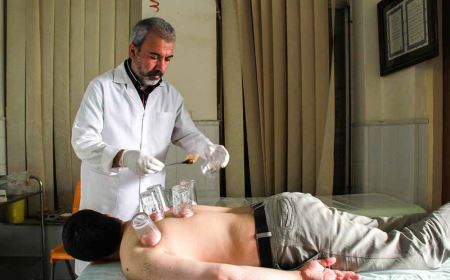 عکس های حجامت و زالو درمانی در ایران (16-)