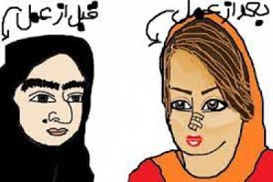 شعر طنز و بسیار جالب دماغ عملی