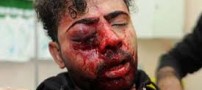 ماجرای دردناک کور کردن چشم برادر بخاطر توهم !