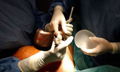 جراحی زیبایی سینه و نکات مهم جراحی (عکس)