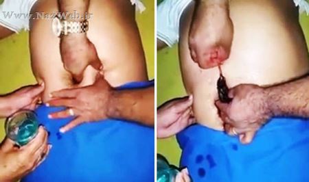 بیرون کشیدن یک موش مرده از ناف این پسر! عکس