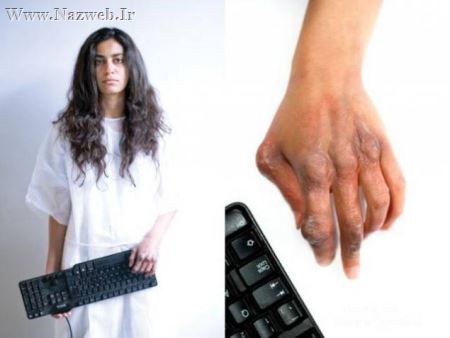 بیماری های عجیب گیمرهای نوجوان (عکس)