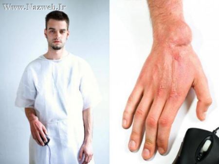 بیماری های عجیب گیمرهای نوجوان (عکس)