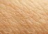 گال چیست؟ شنیدید می گن یارو گال بسته!!