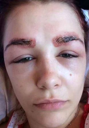 دختری که صورت عجیبش را برای عبرت دختران به نمایش گذاشت (عکس)