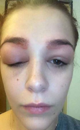 دختری که صورت عجیبش را برای عبرت دختران به نمایش گذاشت (عکس)