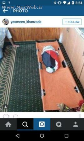 وحشتناک ترین جنایت قرن برای این نوزاد رقم خورد (عکس 16+)