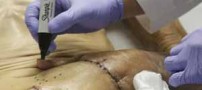 مرد عجیبی که دستش در شکمش رشد می کند ! (15+)
