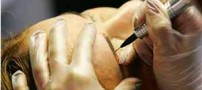 بهترین روش های پاک کردن تاتو