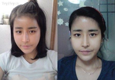 عکس های زیبارویان جراحی شده کره جنوبی