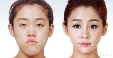 عکس های زیبارویان جراحی شده کره جنوبی