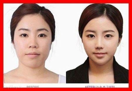 عکس های زیبارویان جراحی شده کره جنوبی