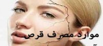موارد مصرف قرص آيرون + ويتامين C