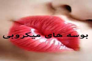 بوسه های میکروبی ! بوسه های میکروبی !