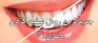 جدیدترین روش برای سفید کردن دندان