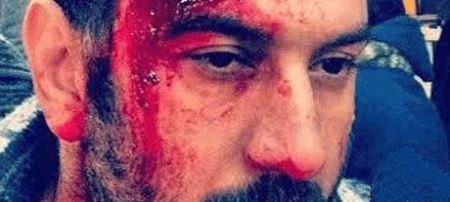علی انصاریان غرق در خون (عکس)