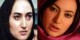 عکس های دیدنی بازیگران زن ایرانی قبل و بعد از جراحی