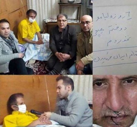 اقدام جنجالی پیشکسوت پرسیولیس با دوختن لبهایش + عکس