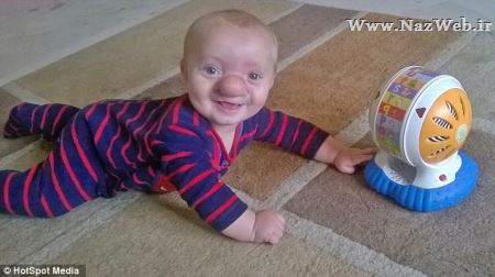عکس های پسر حیرت انگیز و زنده ای که نمی تواند نفس بکشد !