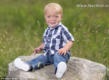 عکس های پسر حیرت انگیز و زنده ای که نمی تواند نفس بکشد !