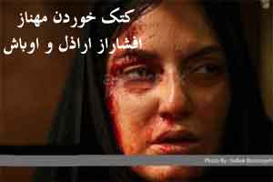 کتک خوردن مهناز افشار از اراذل و اوباش + عکس کتک خوردن مهناز افشار از اراذل و اوباش + عکس