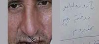 اقدام جنجالی پیشکسوت پرسیولیس با دوختن لبهایش + عکس