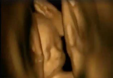 عکس های حیرت انگیز رقص جنین در شکم مادر