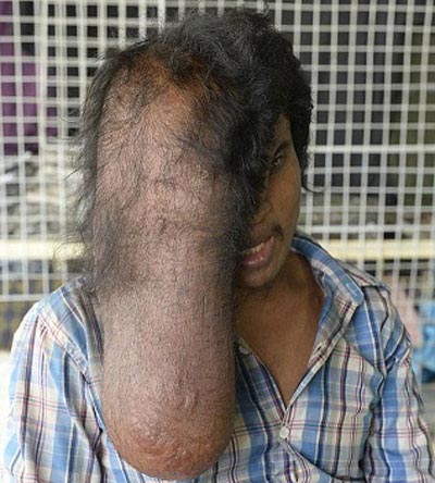 چهره وحشتناک ترین مرد دنیا منتشر شد (عکس) 18+
