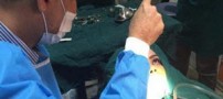 جراحی جنجالی فک خانم مشهدی با هیپنوتیزم !