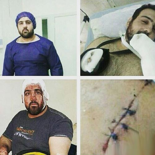 جنجال ضرب و شتم جودوکار ملی توسط ماموران شهرداری (عکس)