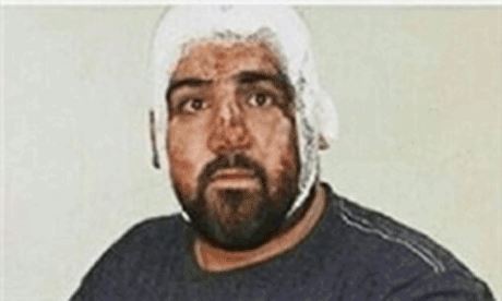 جنجال ضرب و شتم جودوکار ملی توسط ماموران شهرداری (عکس)