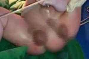 پسری با دو آلت تناسلی و دو مقعد در شیراز (عکس) پسری با دو آلت تناسلی و دو مقعد در شیراز (عکس)