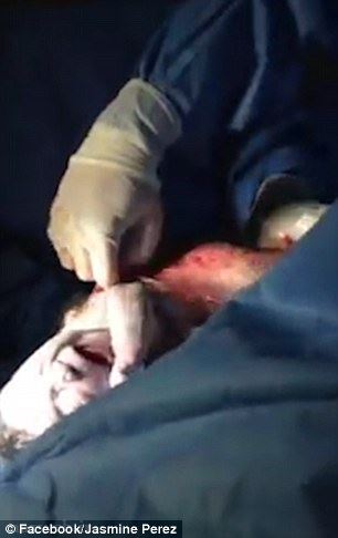 نوزادی که با تولد حیرت انگیز پزشکان را به چالش کشید! عکس