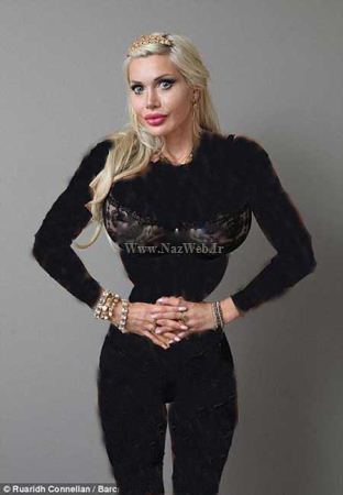 جراحی عجیب کمرباریک ترین زن دنیا برای زیباتر شدن (عکس)