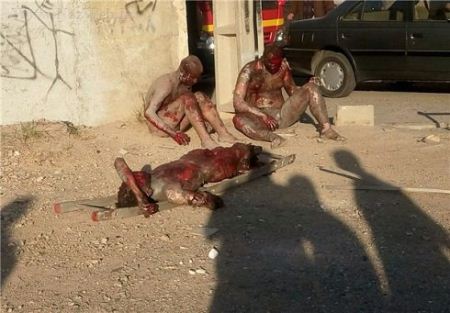 18+ عکس: تکان دهنده ترین انفجار چهارشنبه سوری در اسلامشهر