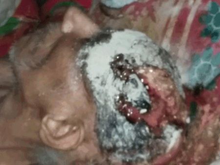 چهره تکان دهنده زن قائمشهری بخاطر استفاده از جادو (عکس)