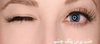 علت پرش پلک چشم چیست