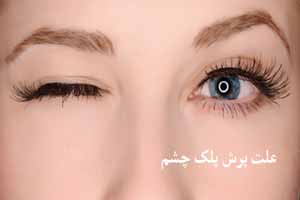 علت پرش پلک چشم چیست علت پرش پلک چشم چیست