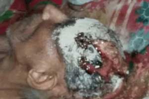 چهره تکان دهنده زن قائمشهری بخاطر استفاده از جادو (عکس) چهره تکان دهنده زن قائمشهری بخاطر استفاده از جادو (عکس)