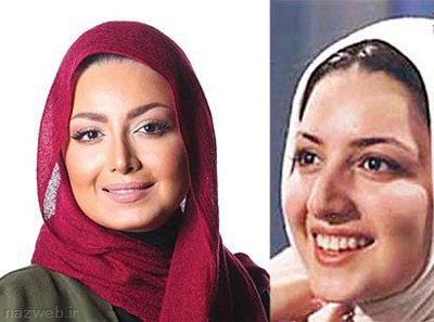 عکس های جالب قبل و بعد از عمل بازیگران ایرانی