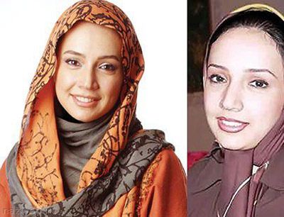عکس های جالب قبل و بعد از عمل بازیگران ایرانی