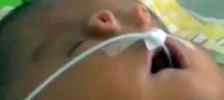 دختری شبیه به خوک متولد شد (عکس)