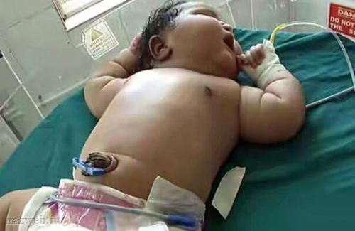 دختر 19 ساله گنده ترین نوزاد جهان را بدنیا آورد! عکس