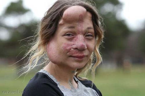 زنی با صورتی بادکنکی و عجیب (عکس)