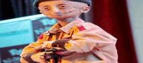 پسر عجیب نوجوان که 8 برابر سنش پیرتر است! عکس