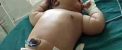 دختر 19 ساله گنده ترین نوزاد جهان را بدنیا آورد! عکس