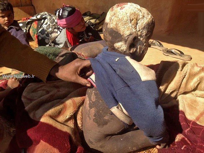 عکس های پسری که با سنگ شدنش دنیا را شوکه کرد 18+