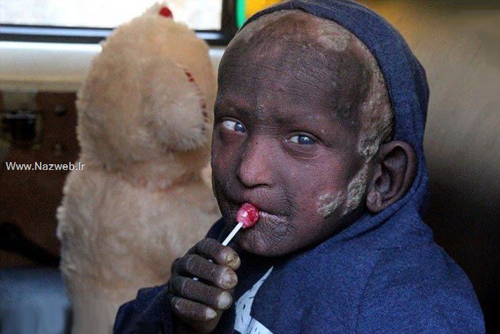 عکس های پسری که با سنگ شدنش دنیا را شوکه کرد 18+