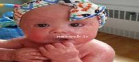 دختر عجیبی که هر 4 ساعت تمام پوستش می ریزد! عکس